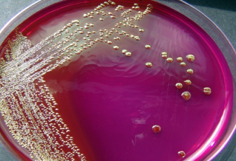 Zasady prowadzenia w Polsce monitoringu na obecność Shiga toksycznych bakterii E. coli