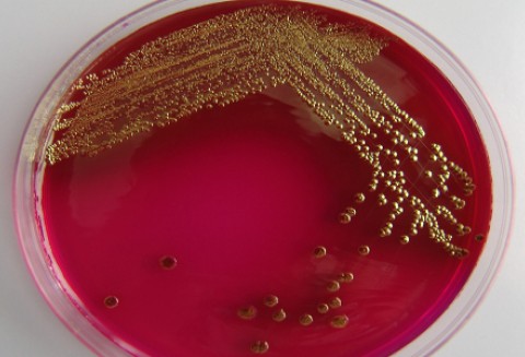 W Polsce odnotowano już dwa przypadki zakażenia bakterią E.coli