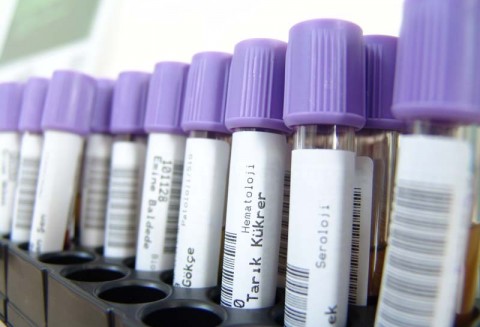 Niemcy – Znaleziono nowy szczep pałeczki okrężnicy EHEC